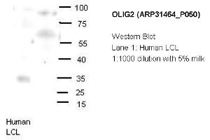 Image no. 2 for anti-Oligodendrocyte Lineage Transcription Factor 2 (OLIG2) (N-Term) antibody (ABIN2777314) (OLIG2 anticorps  (N-Term))