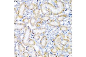 Immunohistochemistry of paraffin-embedded rat kidney using WRB antibody at dilution of 1:200 (40x lens). (WRB anticorps)