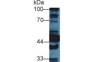 Detection of ALDH1A1 in Mouse Liver lysate using Polyclonal Antibody to Aldehyde Dehydrogenase 1 Family, Member A1 (ALDH1A1) (ALDH1A1 anticorps  (AA 1-326))