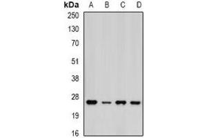 Western blot analysis of PSMA5 expression in MCF7 (A), HepG2 (B), mouse liver (C), mouse heart (D) whole cell lysates. (PSMA5 anticorps)