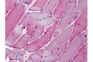 Human Skeletal Muscle: Formalin-Fixed, Paraffin-Embedded (FFPE) (OSBPL1A anticorps  (C-Term))
