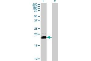 Western Blot analysis of NPC2 expression in transfected 293T cell line by NPC2 monoclonal antibody (M01), clone 4B9. (NPC2 anticorps  (AA 1-151))