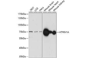 Western blot analysis of extracts of various cell lines, using V1A antibody (ABIN7265765) at 1:1000 dilution.