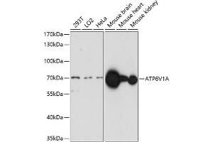 Western blot analysis of extracts of various cell lines, using V1A antibody (ABIN7265765) at 1:1000 dilution. (ATP6V1A anticorps  (AA 500-600))