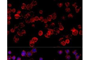 Immunofluorescence analysis of HeLa cells using CYP3A7 Polyclonal Antibody at dilution of 1:100 (40x lens). (CYP3A7 anticorps)