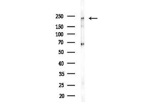 anti-WNK Lysine Deficient Protein Kinase 1 (WNK1) (pThr60) antibody