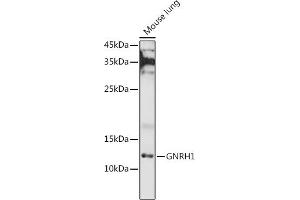 Western blot analysis of extracts of Mouse lung, using GNRH1 antibody (ABIN6131875, ABIN6141257, ABIN6141258 and ABIN6221260) at 1:1000 dilution. (GNRH1 anticorps  (AA 24-92))