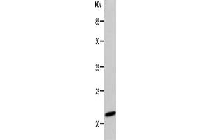 Western Blotting (WB) image for anti-Deoxyuridine Triphosphatase (DUT) antibody (ABIN2425781)