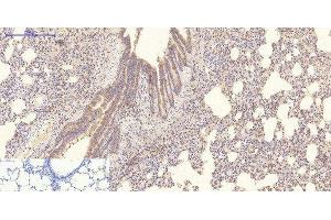 Immunohistochemistry of paraffin-embedded Rat lung tissue using COL4A1 Monoclonal Antibody at dilution of 1:200.
