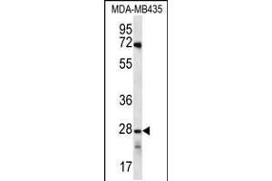Western blot analysis in MDA-MB435 cell line lysates (35ug/lane). (OR10AG1 anticorps  (C-Term))