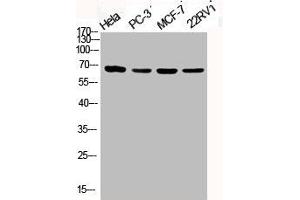 Western Blot analysis of HELA PC3 MCF7 22RV1 cells using Phospho-PKC ζ (T410) Polyclonal Antibody (PKC zeta anticorps  (pThr410))