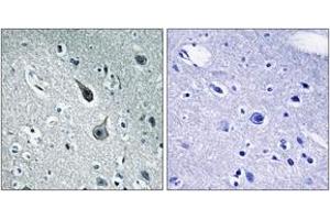 Immunohistochemistry analysis of paraffin-embedded human brain tissue, using 5-HT-2A Antibody.
