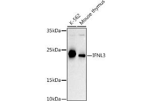 Western blot analysis of extracts of various cell lines, using IFNL3 antibody (ABIN6132858, ABIN6142207, ABIN6142209 and ABIN6221289) at 1:500 dilution. (IL28B anticorps  (AA 22-196))