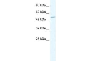 WB Suggested Anti-TPTE Antibody Titration:  1. (TPTE anticorps  (C-Term))
