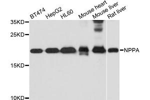 Western blot analysis of extracts of various cell lines, using NPPA antibody. (NPPA anticorps)