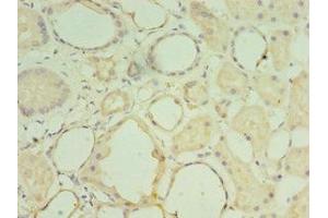 Immunohistochemistry of paraffin-embedded human kidney tissue using ABIN7159050 at dilution of 1:100 (Matrilin 3 anticorps  (AA 277-486))