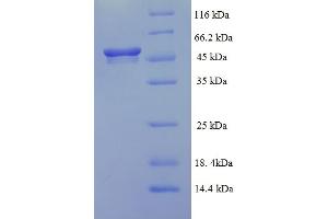 SDS-PAGE (SDS) image for Aldehyde Dehydrogenase 5 Family, Member A1 (ALDH5A1) (AA 48-535) protein (His tag) (ABIN5713214)