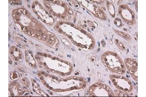 Image no. 2 for anti-Epithelial Cell Adhesion Molecule (EPCAM) (AA 24-265) antibody (ABIN1491256) (EpCAM anticorps  (AA 24-265))
