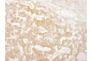 Immunohistochemistry (IHC) image for anti-Insulin Receptor Substrate 1 (IRS1) (AA 1192-1242) antibody (ABIN7448979)