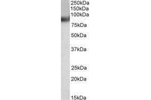 AP22452PU-N TRIM55 antibody staining of Human Heart lysate at 0.