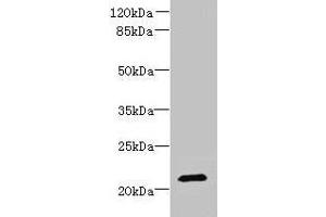 Western blot All lanes: DYDC1 antibody at 4 μg/mL + Hela whole cell lysate Secondary Goat polyclonal to rabbit IgG at 1/10000 dilution Predicted band size: 21, 22 kDa Observed band size: 21 kDa (DYDC1 anticorps  (AA 1-177))