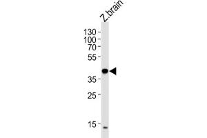Western Blotting (WB) image for anti-Eukaryotic Translation Initiation Factor 3 Subunit E (EIF3E) antibody (ABIN3000922) (EIF3E anticorps)