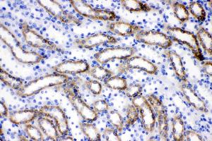 ACSL1 was detected in paraffin-embedded sections of rat kidney tissues using rabbit anti- ACSL1 Antigen Affinity purified polyclonal antibody (Catalog # ) at 1 ?