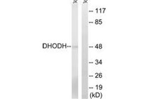 Western blot analysis of extracts from Jurkat cells, using DHODH Antibody. (DHODH anticorps  (AA 211-260))