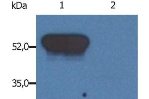 Western Blotting analysis (reducing conditions) of GFAP in porcine brain lysate.