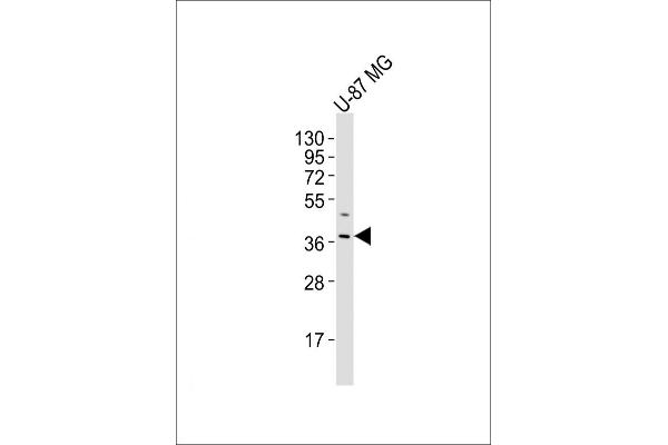 OR4K17 抗体  (AA 87-120)