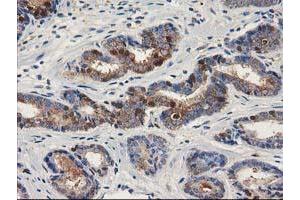 Immunohistochemistry (IHC) image for anti-Aldehyde Dehydrogenase 1 Family, Member A3 (ALDH1A3) (AA 1-100), (AA 413-512) antibody (ABIN1490536)