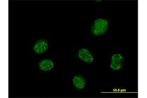 Immunofluorescence of purified MaxPab antibody to ELAC1 on HeLa cell. (ELAC1 anticorps  (AA 1-363))