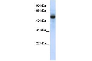 CXORF34 antibody used at 1 ug/ml to detect target protein. (TRMT2B anticorps  (N-Term))