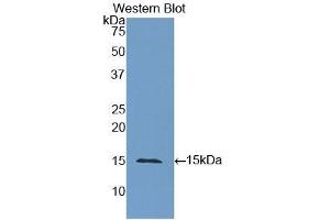 Detection of Recombinant CEA, Human using Polyclonal Antibody to Carcinoembryonic Antigen (CEA) (CEA anticorps  (AA 448-572))