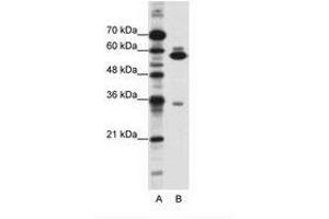 Image no. 1 for anti-Zinc Finger Protein 446 (ZNF446) (C-Term) antibody (ABIN202554) (ZNF446 anticorps  (C-Term))