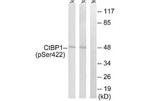Western blot analysis of extracts from Jurkat cells treated with TNF using CtBP1 (Phospho-Ser422) Antibody. (CTBP1 anticorps  (pSer422))