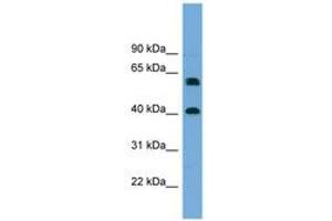 Image no. 1 for anti-Telomeric Repeat Binding Factor 2, Interacting Protein (TERF2IP) (AA 215-264) antibody (ABIN6744163) (RAP1 anticorps  (AA 215-264))