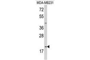 Western blot analysis of IL12A Antibody (C-term) in MDA-MB231 cell line lysates (35ug/lane). (IL12A anticorps  (C-Term))