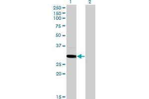 Western Blot analysis of MED6 expression in transfected 293T cell line by MED6 monoclonal antibody (M07), clone 4C2. (MED6 anticorps  (AA 1-246))