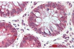 Detection of DEP1 in Human Colon Tissue using Polyclonal Antibody to Density Enhanced Phosphatase 1 (DEP1)