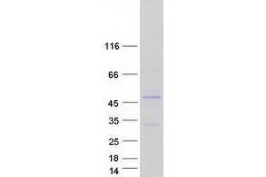 Validation with Western Blot