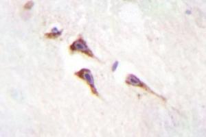 Image no. 2 for anti-Mechanistic Target of Rapamycin (serine/threonine Kinase) (mTOR) antibody (ABIN272127) (MTOR anticorps)