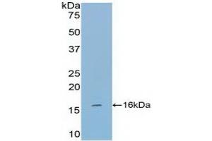 Detection of Recombinant TPS, Mouse using Polyclonal Antibody to Tryptase (TPS) (TPSAB1 anticorps  (AA 149-273))