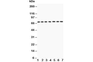 Western blot testing of Lamin A antibody and Lane 1:  human placenta;  2: SKOV;  3: SW620;  4: COLO320;  5: HeLa;  6: 293T;  7: A549 lysate (Lamin A/C anticorps  (AA 481-646))