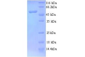 SDS-PAGE (SDS) image for N-Myc Proto-Oncogene Protein (MYCN) (AA 1-464), (full length) protein (His tag) (ABIN5713686)