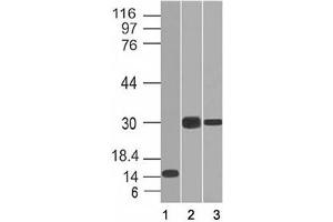 Western blot of 1) partial recombinant protein, 2) Panc-28 and 3) PANC1 cell lysate using CELA3B antibody (CELA3B/1218). (Elastase 3B anticorps  (AA 82-238))