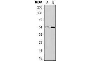 Western blot analysis of GABRD expression in HT29 (A), PC12 (B) whole cell lysates.