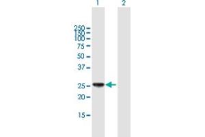 Western Blot analysis of HLA-DPB1 expression in transfected 293T cell line by HLA-DPB1 MaxPab polyclonal antibody. (HLA-DPB1 anticorps  (AA 1-258))