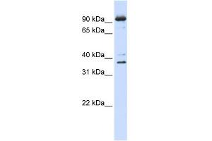 WB Suggested Anti-NCBP1 Antibody Titration:  0. (NCBP1 anticorps  (N-Term))