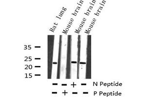 Western blot analysis of Phospho-RhoA (Ser188) expression in various lysates (RHOA anticorps  (pSer188))